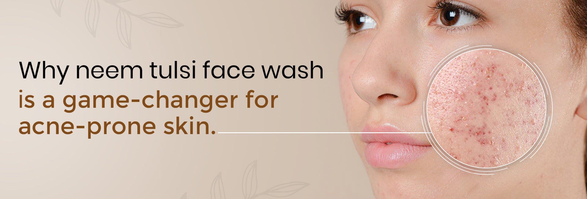 Why Neem Tulsi Face Wash is a Game-Changer for Acne-Prone Skin